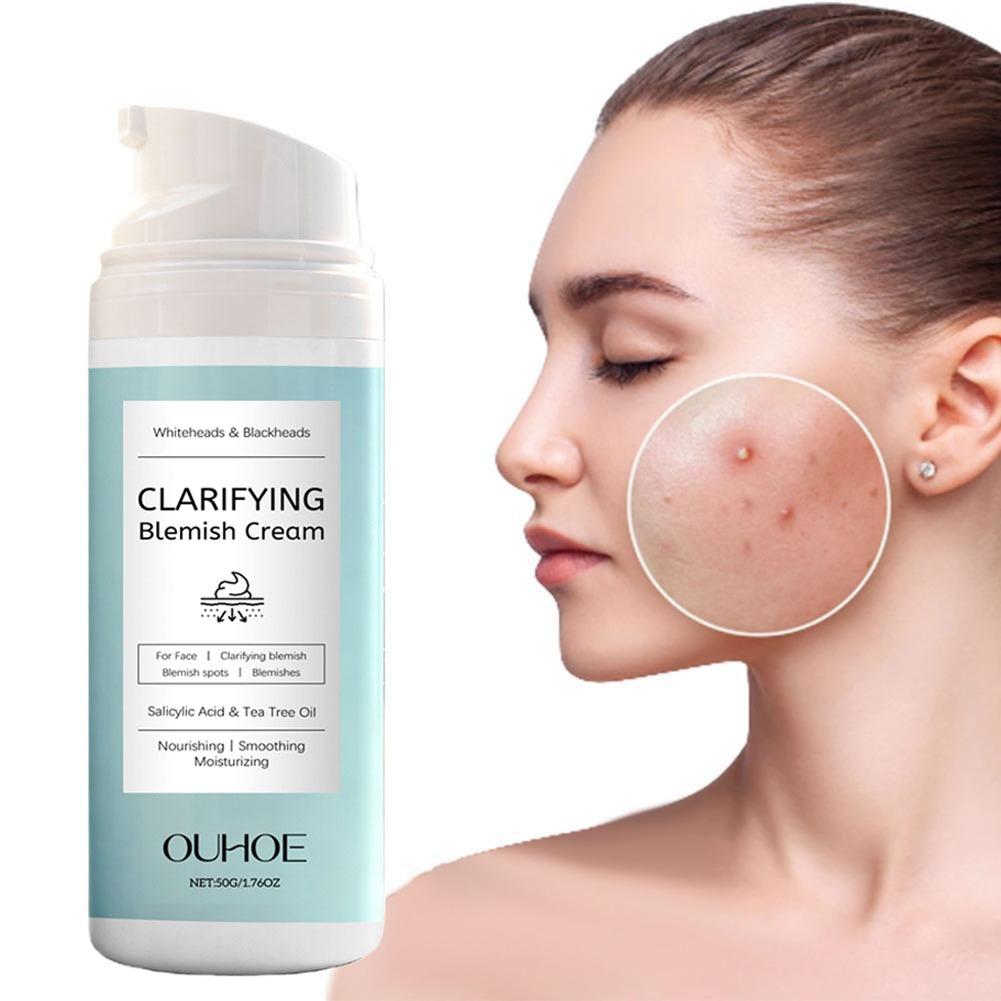 Azelaic Acid Cream - ニキビができやすい肌のためのサリチル酸配合フェイシャルクリーム、オイルコントロール、鎮静、軽量、べたつかない保湿剤、混合肌用