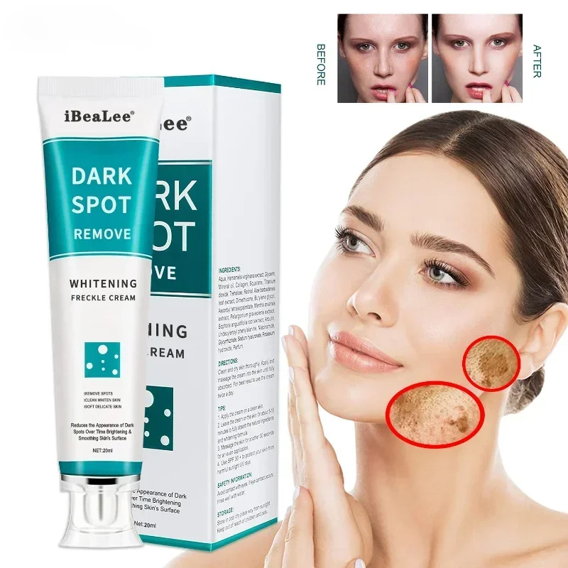 Skincare Glowing - そばかすや色素沈着のための色素沈着のための美白クリーム,暗い色素沈着のための色素沈着のための軟膏,軽い肌のケア