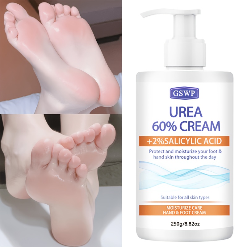 Azelaic Acid Cream - GSWP 60%尿素配合保湿ハンド＆フットクリーム、サリチル酸配合、手足を保護し栄養を与えます。 250g/500g