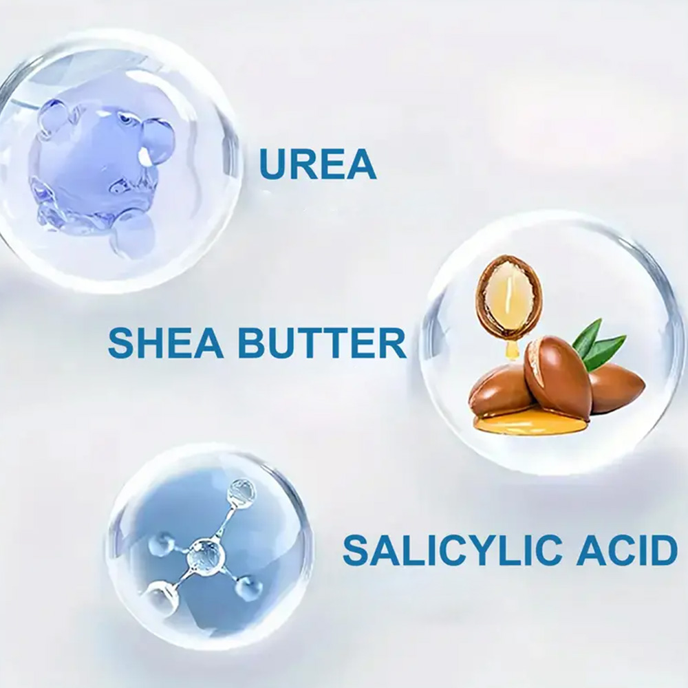 ヤングカム 250g 尿素クリーム サリチル酸配合 - 乾燥 - Azelaic Acid Cream のレビューと価格