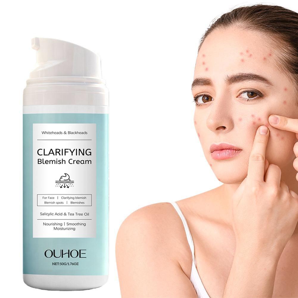 ニキビができやすい肌のためのサリチル酸配合フェイシャルクリー - Azelaic Acid Cream のレビューと価格