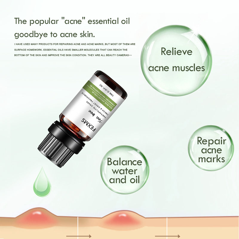 ティーツリー100% ピュアエッセンシャルオイル,肌,髪,乾 - Tea Tree Spot Treatment のレビューと価格