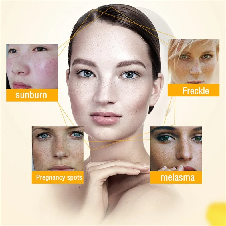 そばかすや色素沈着のための色素沈着のための美白クリーム,暗い - Skincare Glowing のレビューと価格