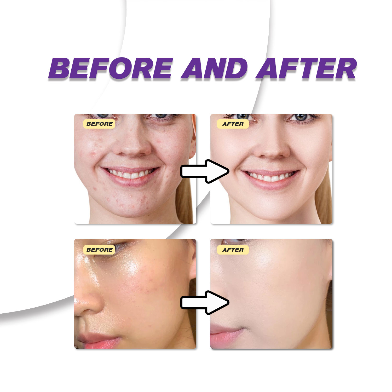 マイルドなアゼライン酸クリームは、くすんだ肌を改善し、荒れた - Azelaic Acid Cream のレビューと価格