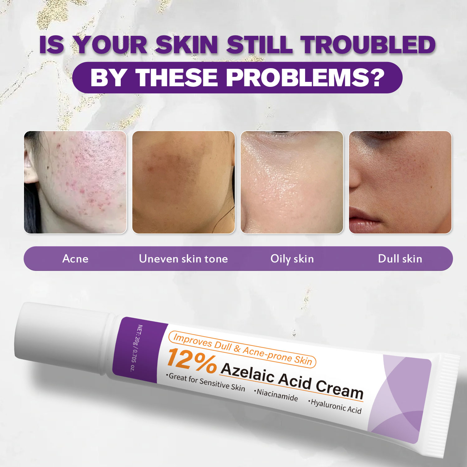 マイルドなアゼライン酸クリームは、くすんだ肌を改善し、荒れた - Azelaic Acid Cream のレビューと価格
