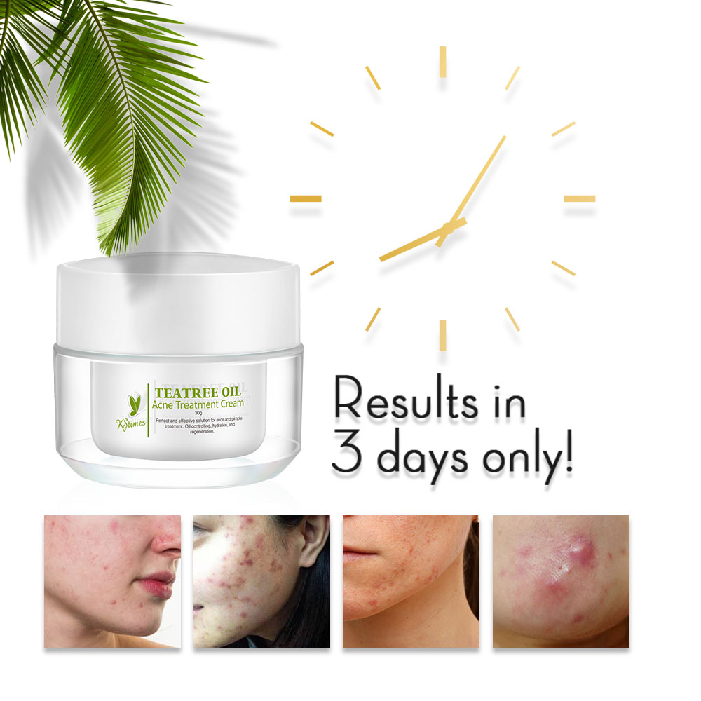 Kstims-にきび治療クリーム,美容液,そばかす,色素沈着 - Tea Tree Spot Treatment のレビューと価格